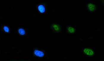 FIP1L1 Antibody