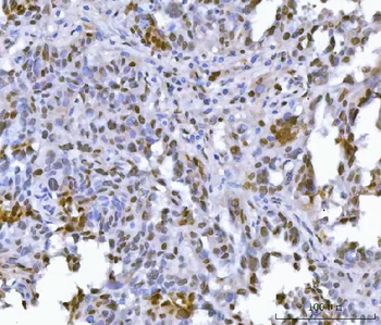 FIP1L1 Antibody