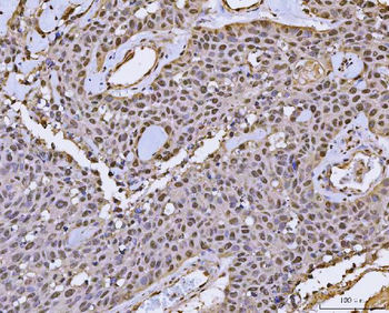 FIP1L1 Antibody