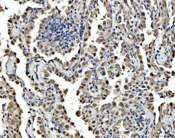 FIP1L1 Antibody