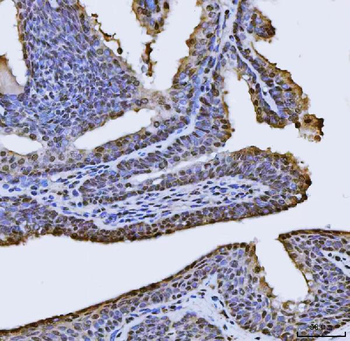 FIP1L1 Antibody
