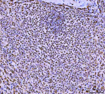 FIP1L1 Antibody