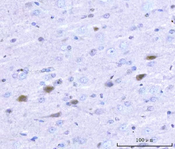 Adgrg1 Antibody