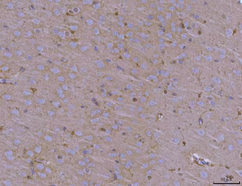 ADAM22 Rabbit Polyclonal Antibody