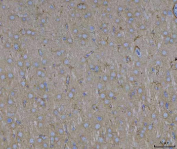 ADAM22 Rabbit Polyclonal Antibody