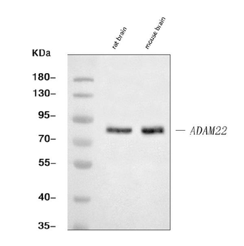 ADAM22 Rabbit Polyclonal Antibody