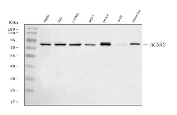 ACSS2 Rabbit Polyclonal Antibody