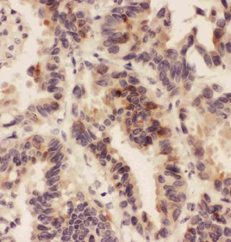 HSD11B1 Rabbit Polyclonal Antibody