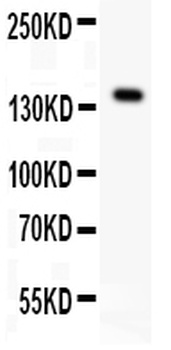VEGF Receptor 1/FLT1 Rabbit Polyclonal Antibody