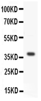 Protein Wnt-3a Wnt3a Rabbit Polyclonal Antibody