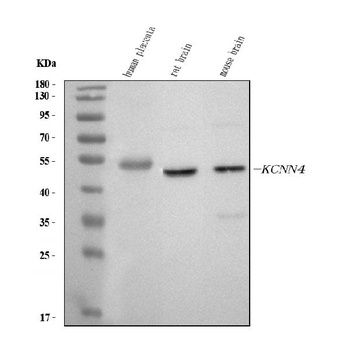 KCNN4 Rabbit Polyclonal Antibody
