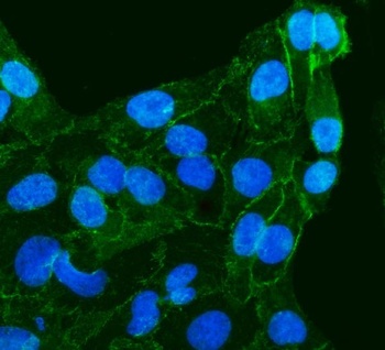 gamma Catenin/JUP Rabbit Polyclonal Antibody