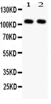 NFkB/NFKB1 p105/p50 Rabbit Polyclonal Antibody