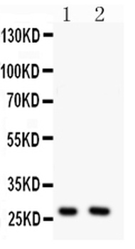 Olig1 Rabbit Polyclonal Antibody