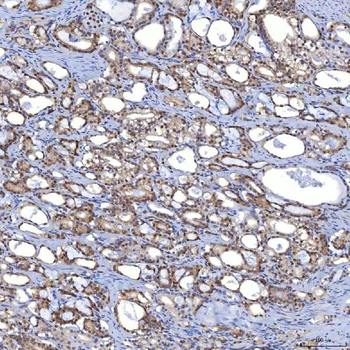 TRMT61A Antibody