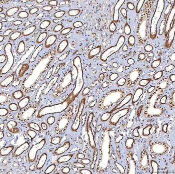 TRMT61A Antibody