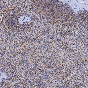 TRMT61A Antibody