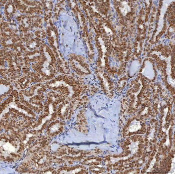TRMT61A Antibody