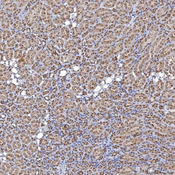 TRMT61A Antibody