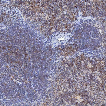 TRMT61A Antibody