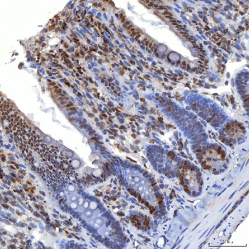 TRMT61A Antibody