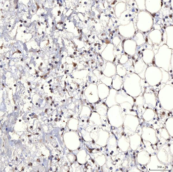 TRMT61A Antibody