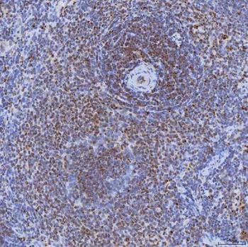 TRMT61A Antibody