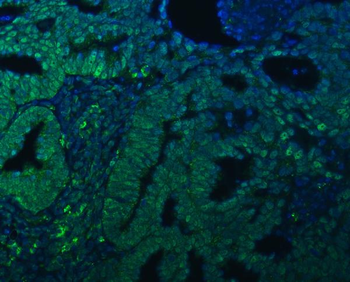 TRMT61A Antibody