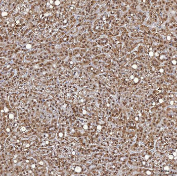 TRMT61A Antibody