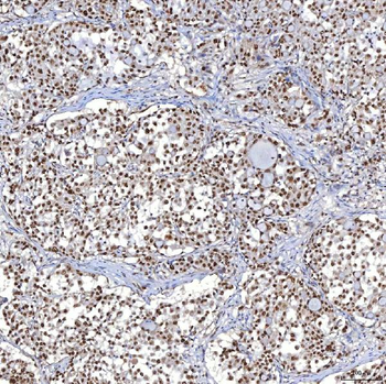TRMT61A Antibody