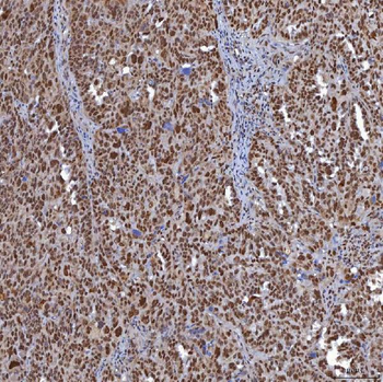 TRMT61A Antibody