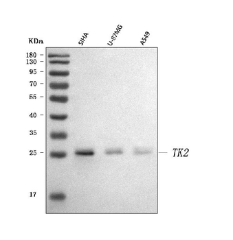 Thymidine Kinase 2/TK2 Rabbit Polyclonal Antibody
