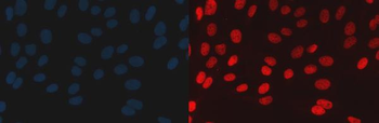 BAF57/SMARCE1 Rabbit Polyclonal Antibody