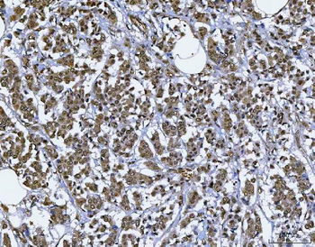 BAF57/SMARCE1 Rabbit Polyclonal Antibody