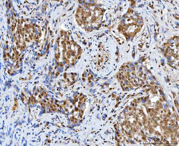 BAF57/SMARCE1 Rabbit Polyclonal Antibody