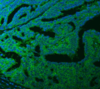 SLC40A1 Antibody