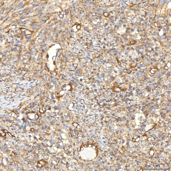 SLC40A1 Antibody