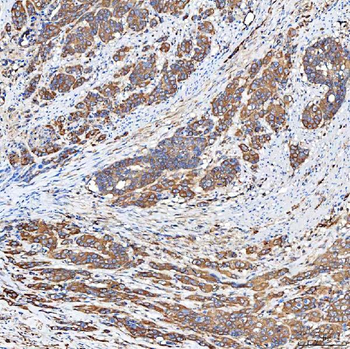SLC40A1 Antibody