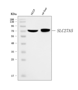 BAL/SLC27A5 Rabbit Polyclonal Antibody