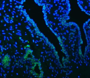 OAT3/SLC22A8 Antibody