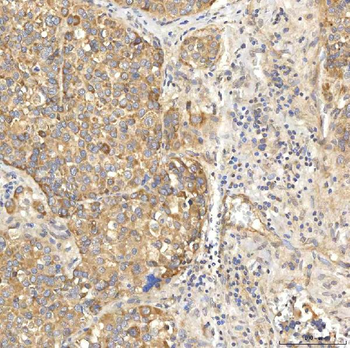 OAT3/SLC22A8 Antibody