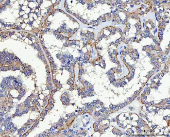 SLC17A5 Rabbit Polyclonal Antibody