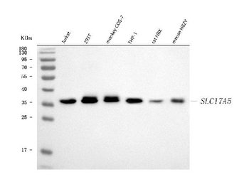 SLC17A5 Rabbit Polyclonal Antibody