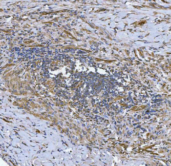 NHERF-2/SIP-1/SLC9A3R2 Antibody