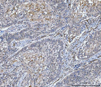 NHERF-2/SIP-1/SLC9A3R2 Antibody
