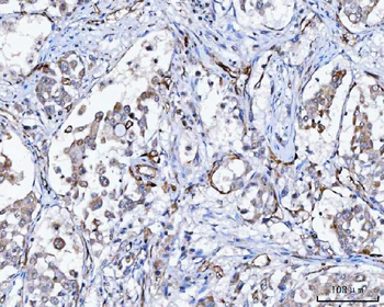 NHERF-2/SIP-1/SLC9A3R2 Antibody