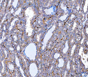 NHERF-2/SIP-1/SLC9A3R2 Antibody