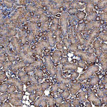 NHERF-2/SIP-1/SLC9A3R2 Antibody