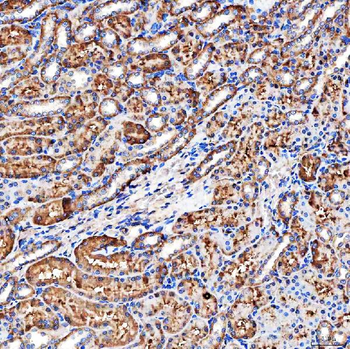 NHERF-2/SIP-1/SLC9A3R2 Antibody