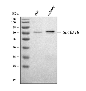 SLC6A18 Rabbit Polyclonal Antibody
